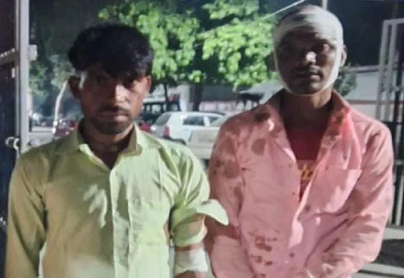 अमरोहा : दूल्हे पक्ष के लोगों की आरती उतारने को लेकर मारपीट, जमकर चले लात-घूंसे...तीन घायल 